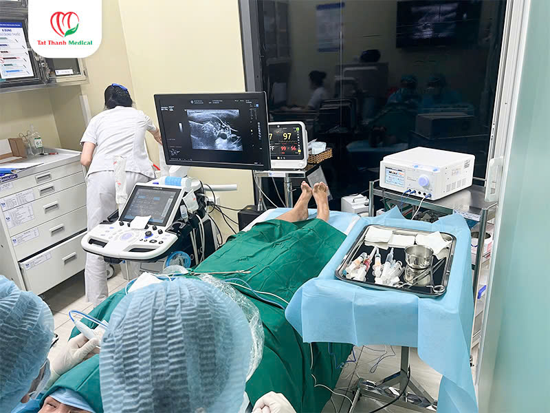 Máy đốt sóng cao tần u tuyến giáp – Giải pháp điều trị tiên tiến cho bệnh viện và phòng khám
