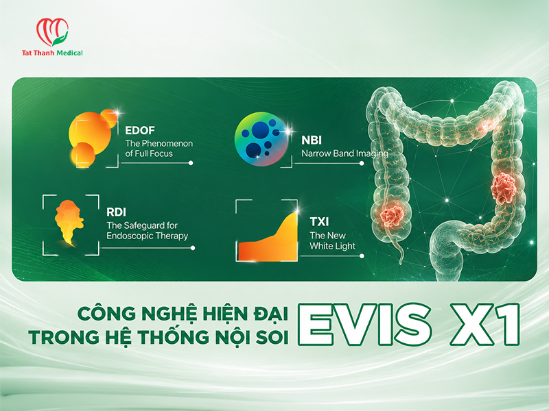 Nội soi phát hiện sớm ung thư đại trực tràng