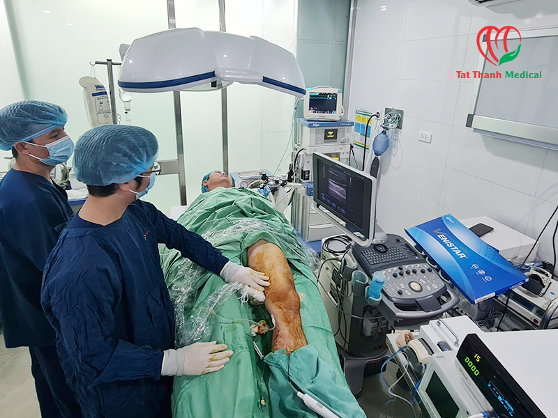 RFA điều trị giãn tĩnh mạch: Xu hướng công nghệ mới đang dần thay thế laser nội tĩnh mạch