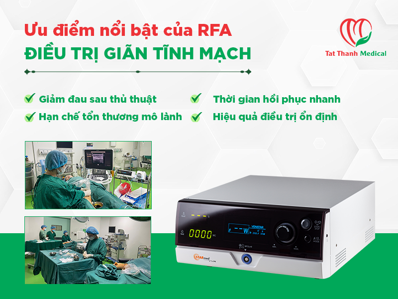 RFA điều trị giãn tĩnh mạch: Xu hướng công nghệ mới đang dần thay thế laser nội tĩnh mạch
