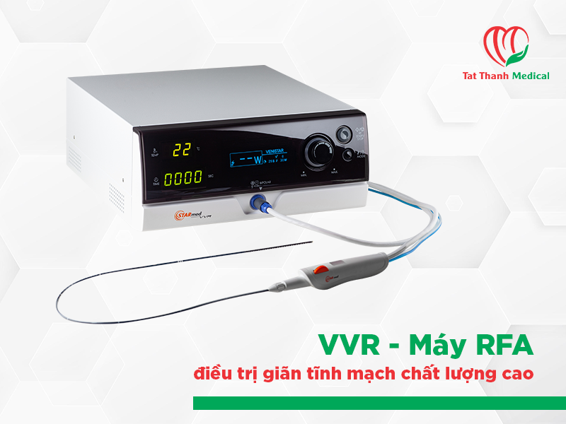 RFA điều trị giãn tĩnh mạch: Xu hướng công nghệ mới đang dần thay thế laser nội tĩnh mạch