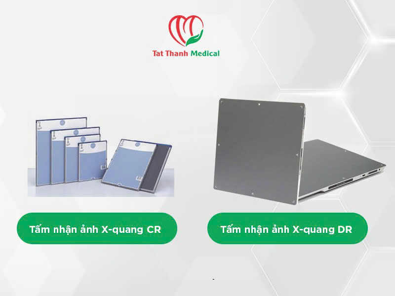 Từ CR sang tấm nhận ảnh X-quang DR: Bước chuyển tất yếu trong hiện đại hóa chẩn đoán hình ảnh