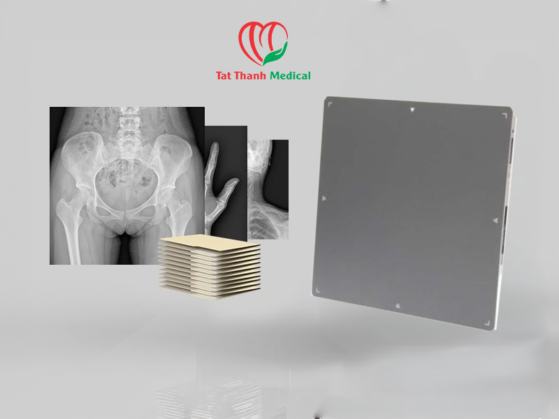 Từ CR sang tấm nhận ảnh X-quang DR: Bước chuyển tất yếu trong hiện đại hóa chẩn đoán hình ảnh